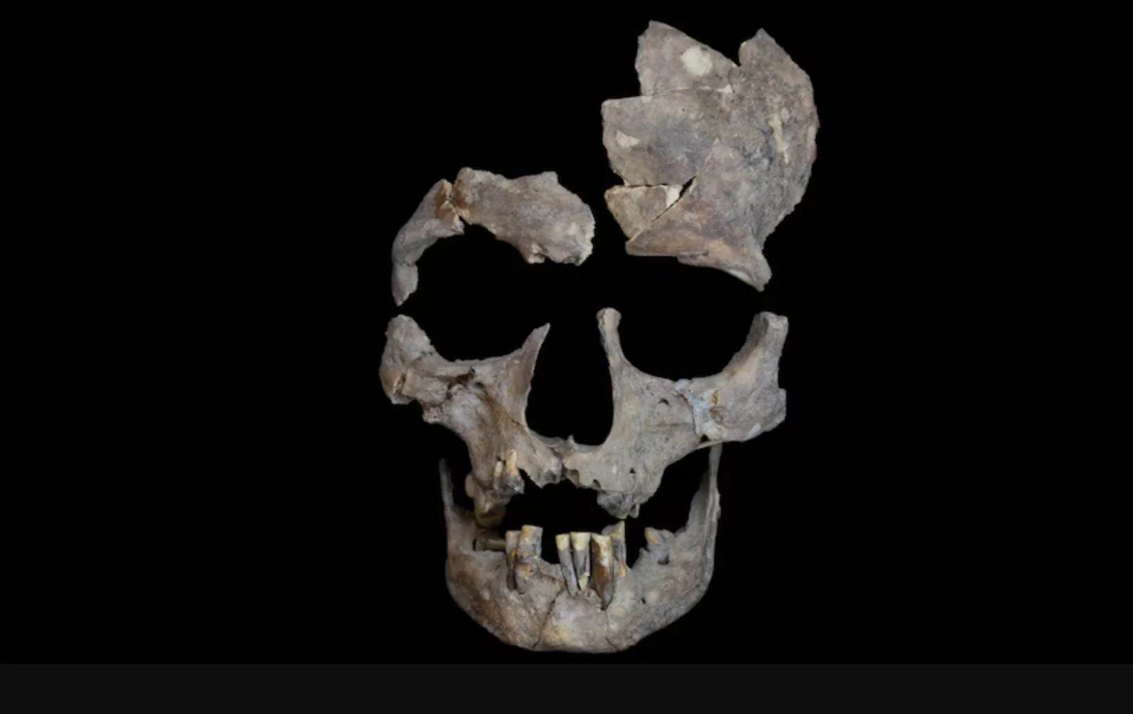 Scientists Discover the Earliest Evidence of Drug Use in 25,000-Year-Old Teeth
